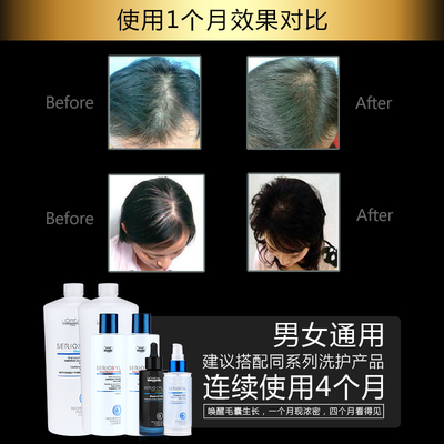 科技賦能防脫，歐萊雅芯基源洗護套裝 深入發芯，重塑強韌發絲
