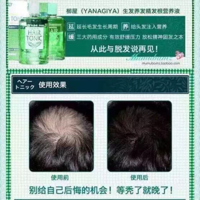 產后脫發怎么辦？這些方法幫你減少掉發，拒絕禿頂危機